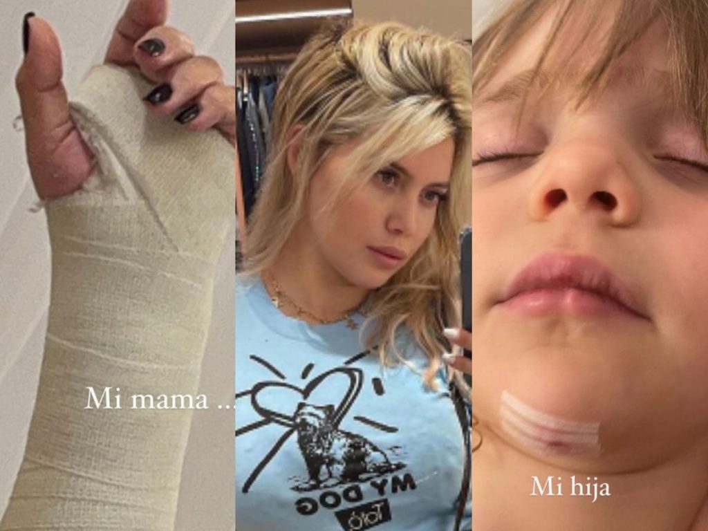 incidente-wanda-nara