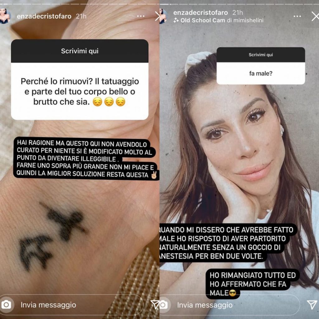 dambrosio-tatuaggio-cancellare