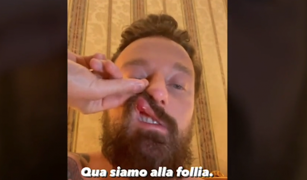 Facchinetti aggredito da Mc Gregor