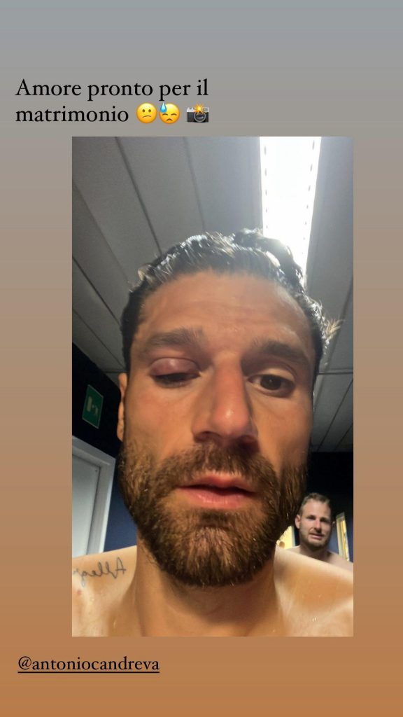 candreva-gonfio