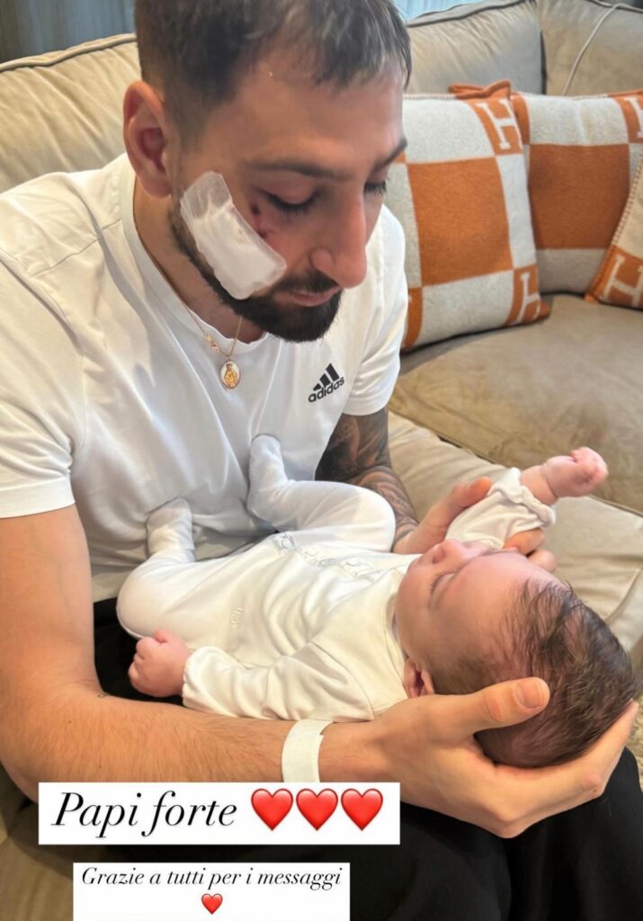 gigio-ferito-moglie