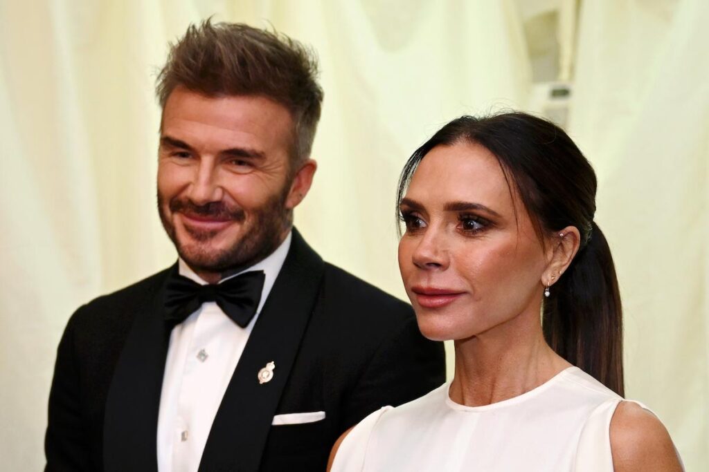 david-beckham-dolore (1)