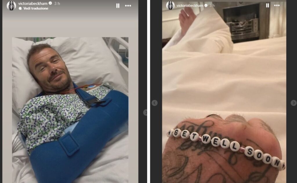 beckham operato braccio victoria foto